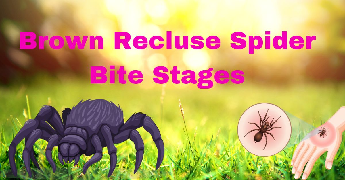 Brown Recluse Spider Bite Stages: