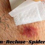 Brown-Recluse-Spiders